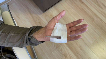 Elinin acsyla gittii hastanede ekilen rntgenle hayatnn okunu yaad