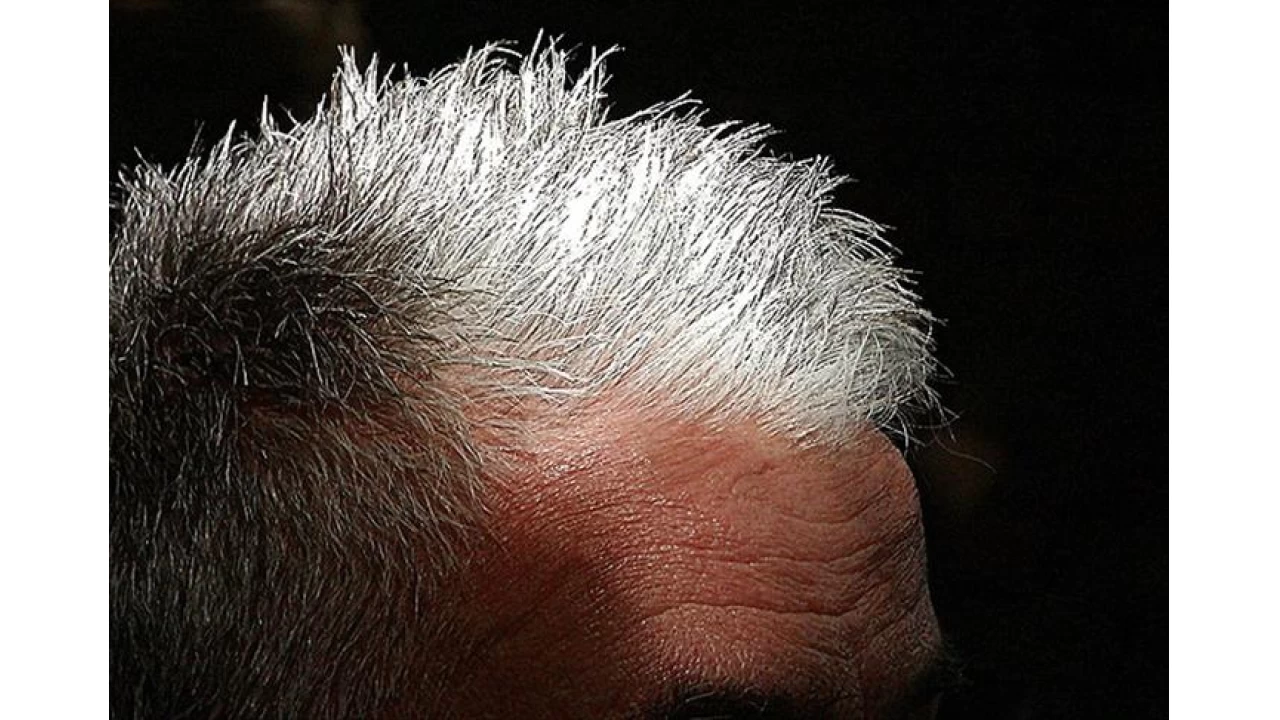 Genç yaşta saç beyazlamasının sırrı