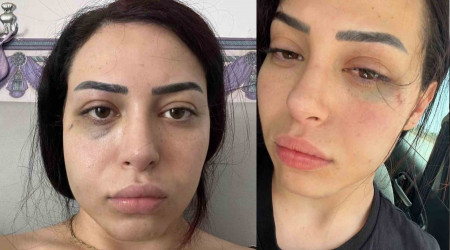 GKRY'de 2 Rum, 25 yaşındaki Türk kızına saldırdı