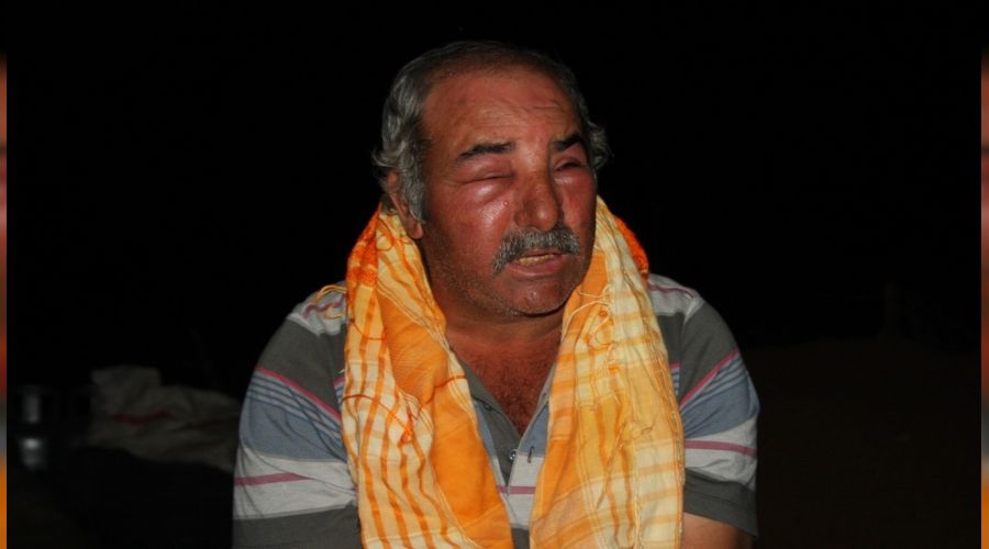 Keçilerini otlatan çoban arıların saldırısına uğradı