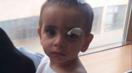 Köpeklerin saldırısına uğrayan minik Asaf hayatını kaybetti