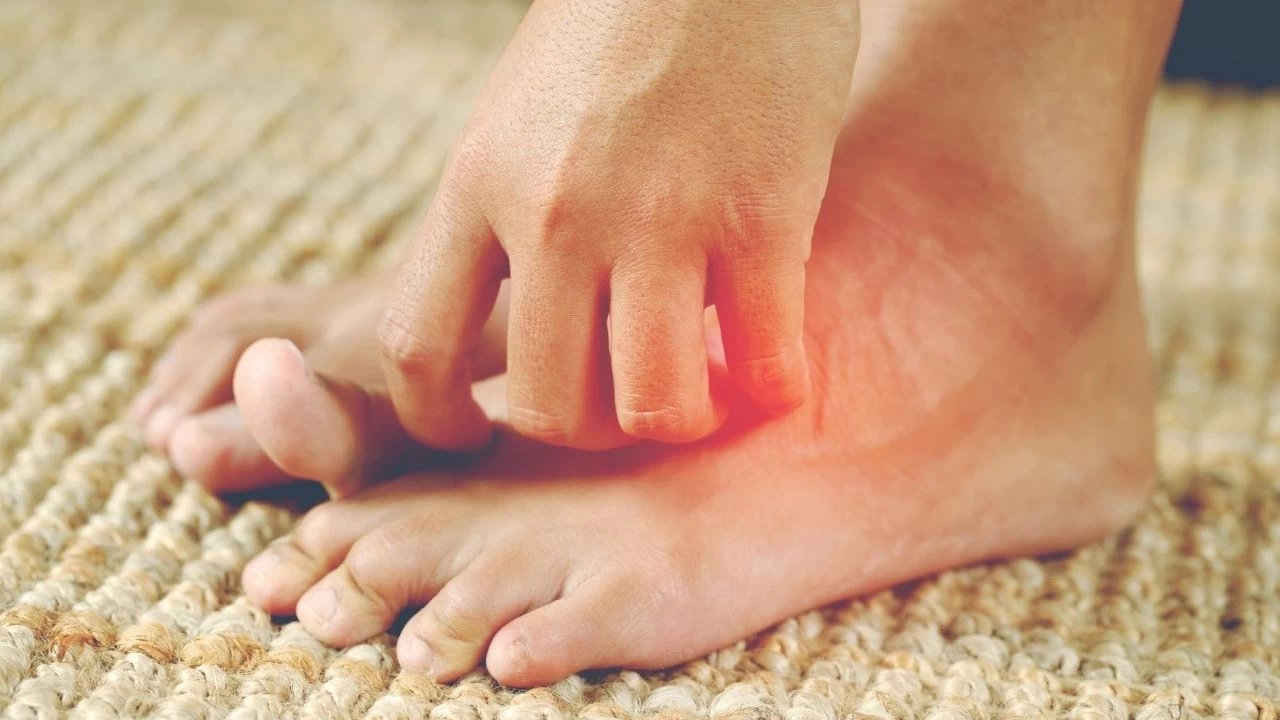 Mantar hastal��� nedir ve nas�l ge�er?