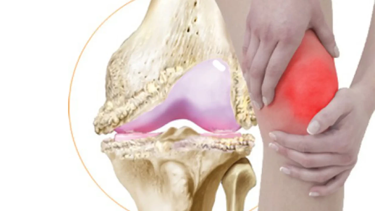 Osteoartritten Kemiklerinizi Koruma Rehberi