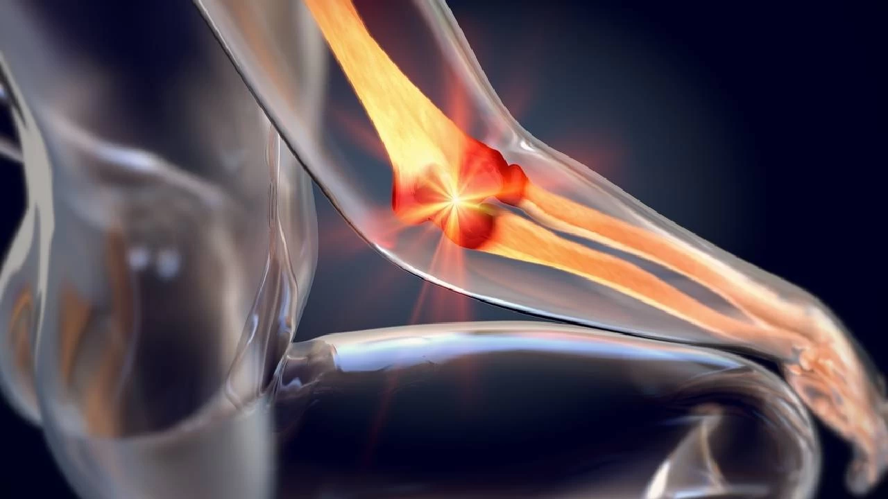 Osteogenezis imperfekta ile yaşamak