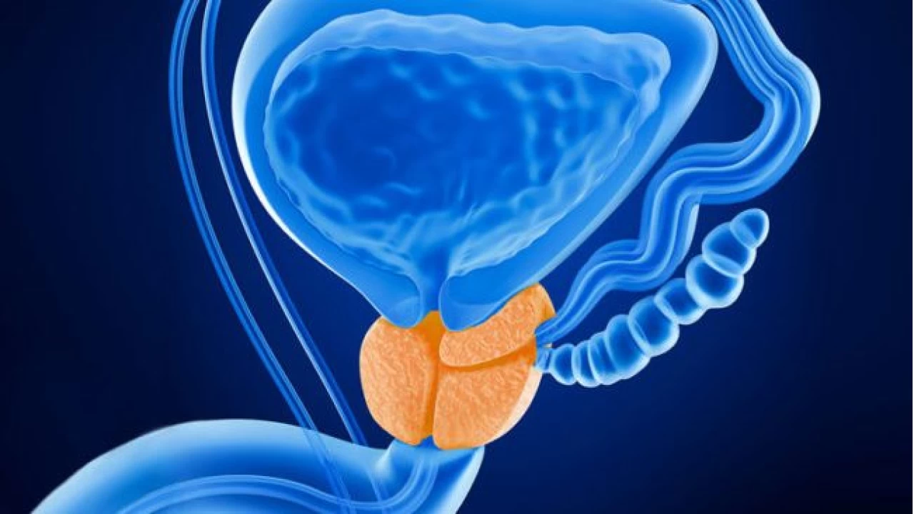 Prostat B�y�mesi Erkeklerin Kabusu