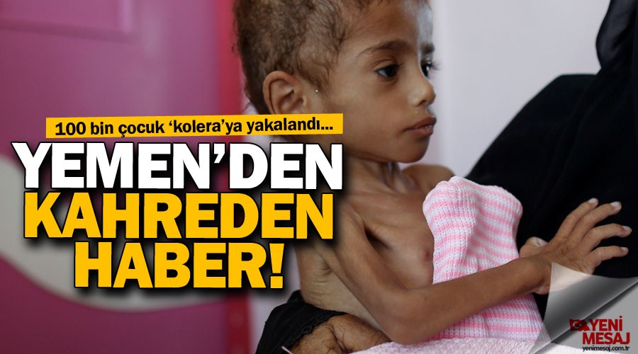 Yemen'de Kolera salgını