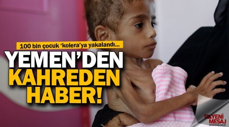 Yemen'de Kolera salgını