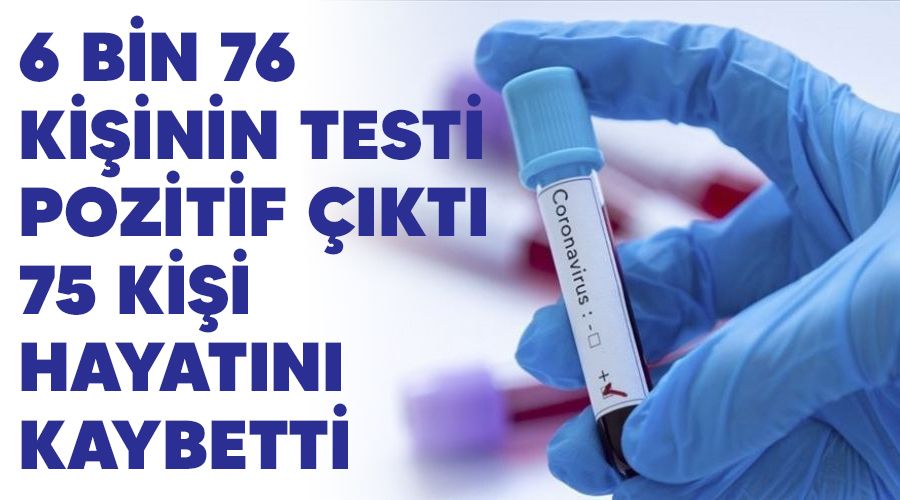 6 bin 76 kişinin testi pozitif çıktı, 75 kişi hayatını kaybetti