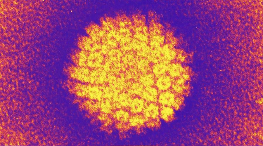 Asr�n vebas�: HPV vir�s�