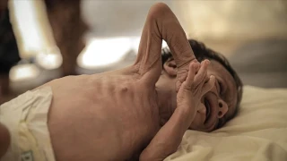 Banglade�'te 15 Mart'tan bu yana k�zam�k belirtileri g�sterdikten sonra �len �ocuk say�s� 409'a ��kt�