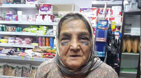 Demir çubukla dövdüğü 73 yaşındaki eşini, bakın ne hale soktu