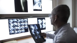 Epilepsi n�betlerinde her saniye �ok k�ymetli