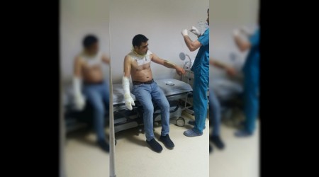 Fırında sıkışan gaz alev aldı