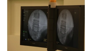 F�t�k Nedir? �e�itleri Nelerdir?