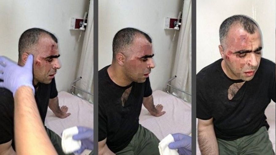Gazeteciye saldıranlar tutuklandı
