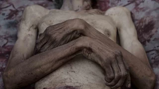 Gazze'de son 24 saatte 6 kişi daha açlık nedeniyle hayatını kaybetti