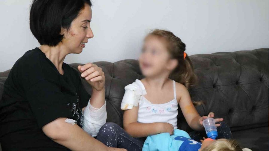İki köpeğin saldırdığı anne-kız ucuz kurtuldu