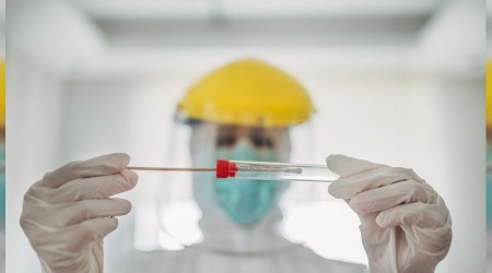 İnternetten test kiti satışına yasak