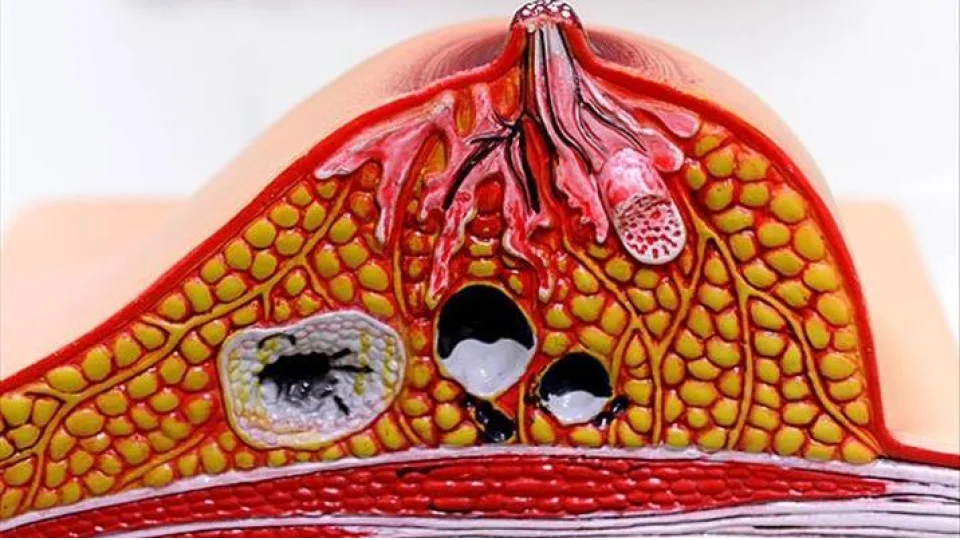 K�t� kolesterole s�k� takip �art