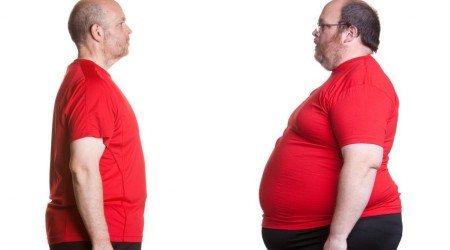 ‘Obezite tedavi edilebilir’