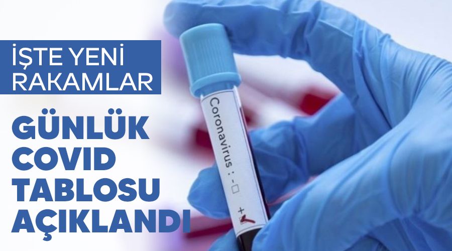 7 bin 112 kiinin Kovid-19 testi pozitif kt, 129 kii vefat etti