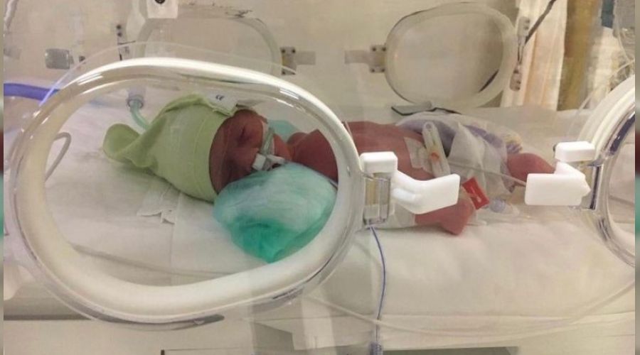 Adana'da prematüre bebekler artıyor