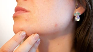 Baharda cilt sorunlar�na kar�� 7 etkili �nlem