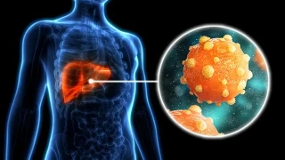 "Hepatit B ve C testinizi ihmal etmeyin"