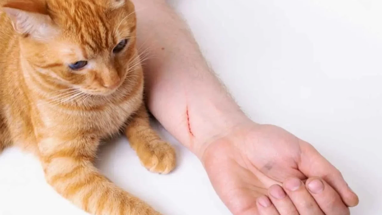 Kedi tırmığı sonrası çocuğa müdahale süreci