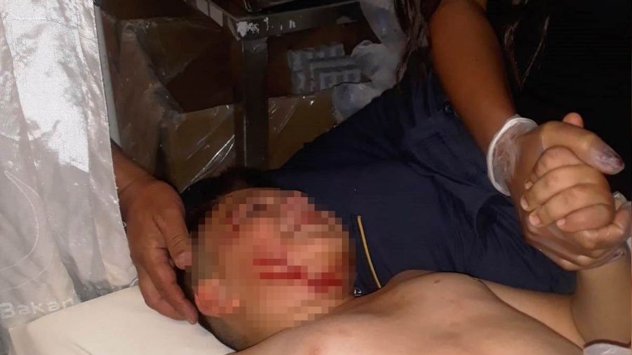 Konya'da k�pe�in sald�rd��� �ocuk hastanelik oldu