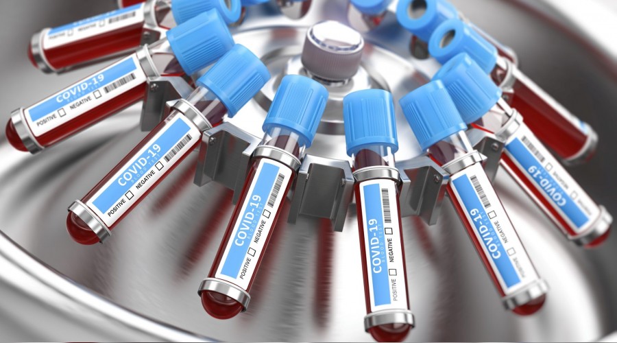 Koronavirs antikorlara alm att!