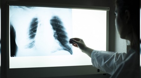 Maalesef KOAH'a yakalananların 10 kişiden 9'u hasta olduğundan habersiz