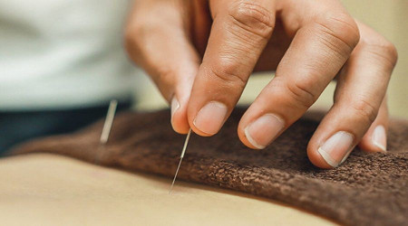 O tedavide akupunktur desteği önem kazanıyor