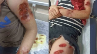 Şanlıurfa'da köpek dehşeti