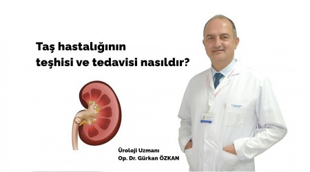 Taş hastalığına lazerli çözüm