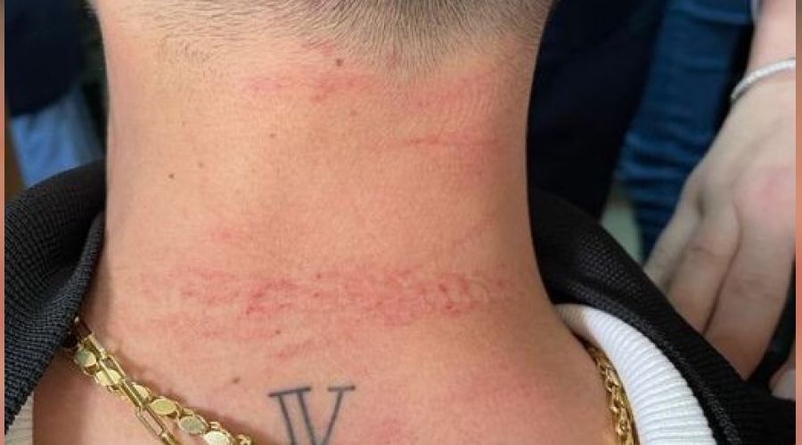 Cerrahpa�a'da doktora sald�ran ki�i g�zalt�nda