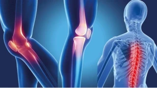 Osteoporoz Riskine Karşı Çay ve Kahvenin Gücü