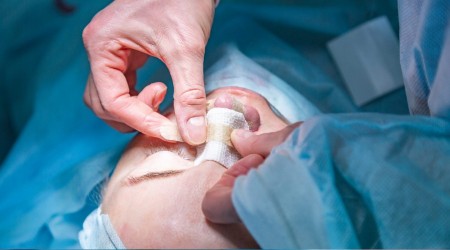 Rinoplasti, birok sorunun zm