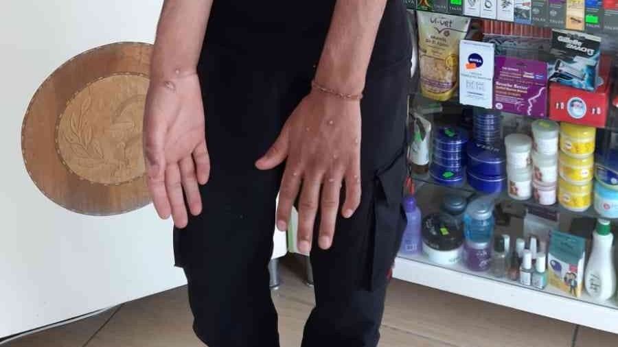 Sultangazi'de 'Maymun �i�e�i' iddias� korkuttu