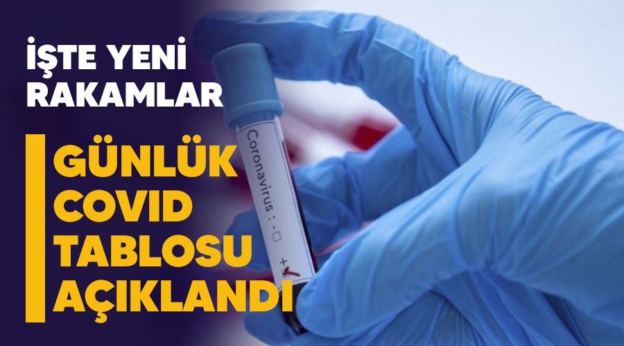 26 bin 476 kişinin testi pozitif çıktı, 356 kişi hayatını kaybetti