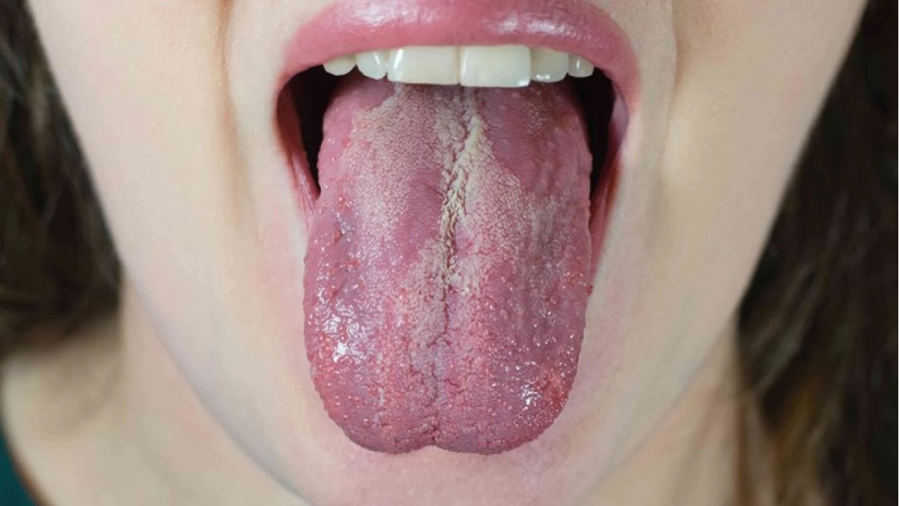 Az mantar: Nedenleri ve tedavisi