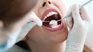 Diş çürükleri nasıl oluşuyorlar ve nasıl önlenir?