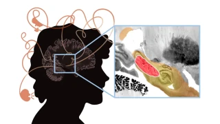 Ger�eklikten Koparan Hastal�k Psikoz Gen� Ya�larda Ba�l�yor 