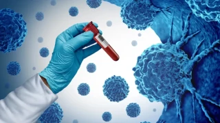 Kanserlerin y�zde 30 ila 50'si �nlenebilir