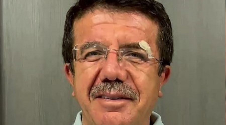 Kazada yaralanan eski Bakan Zeybekçi'den, 'İyiyiz' mesajı