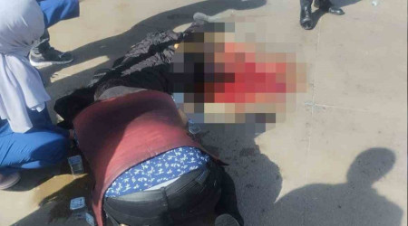 Otobüsün altında kalan hamile kadının bacağı koptu