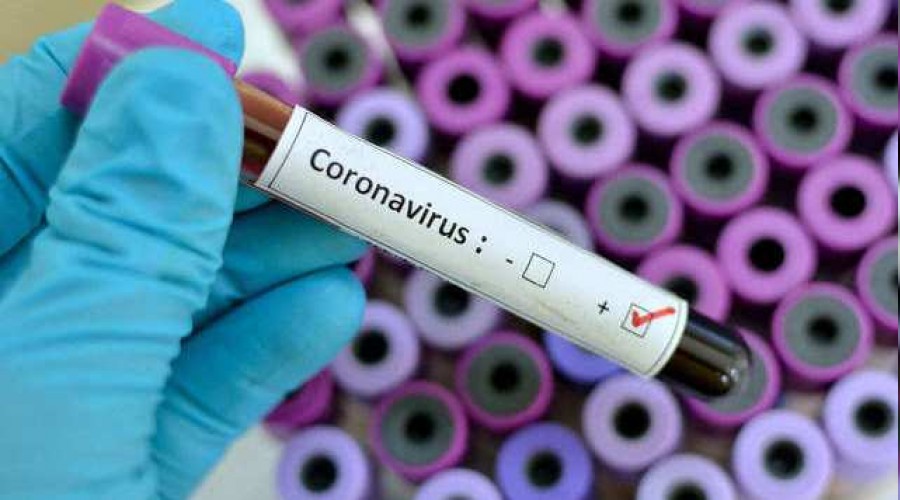 Rus vir�s bilimciden kritik a��klama 