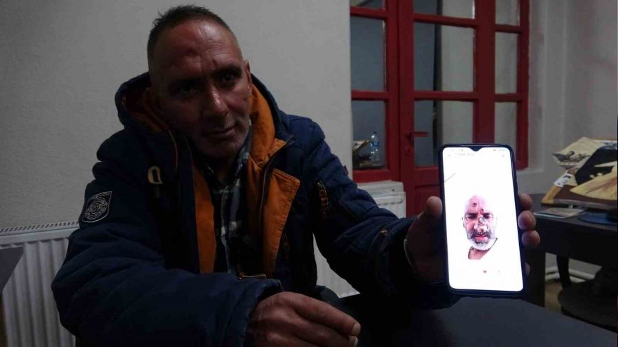 Sinek ısırığı adeta hayatını kararttı