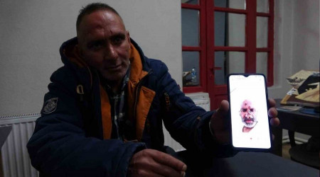 Sinek ısırığı adeta hayatını kararttı
