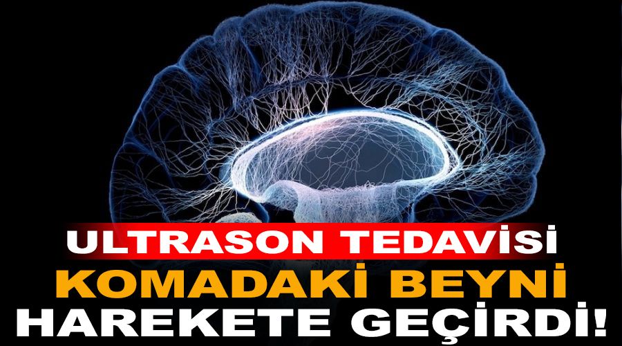 Ultrason tedavisi komadaki beyni harekete geçirdi!
